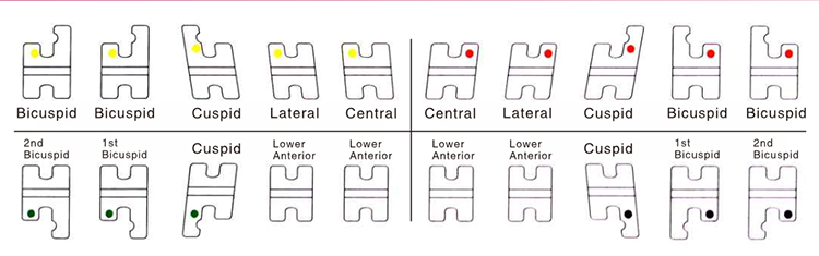 OR2011 Ceramic Brackets